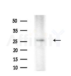 ARD1B Antibody - Western blot analysis of extracts from Rat brain, using ARD1B Antibody at 1/1000 dilution.