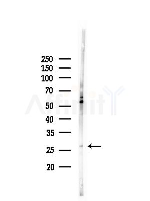 ARD1B Antibody - Western blot analysis of lysates from Rat brain, using ARD1B Antibody at 1/1000 dilution.