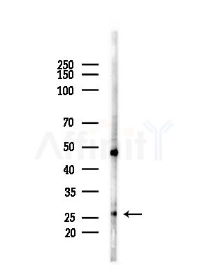 ARD1B Antibody - Western blot analysis of lysates from HUVEC cells(starvation,24h treatment), using ARD1B Antibody at 1/1000 dilution.