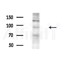 ARHGAP10 Antibody - Western blot analysis of extracts from PC12 cells, using ARHGAP10 Antibody at 1/1000 dilution.
