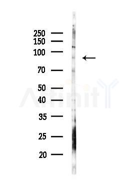 ARHGAP10 Antibody - Western blot analysis of lysates from PC12 cells(LPS, 4h treatment), using ARHGAP10 Antibody at 1/1000 dilution.
