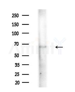 ARHGAP15 Antibody - Western blot analysis of extracts from COLO205 cells(heat-shock treatment), using ARHGAP15 Antibody at 1/1000 dilution.