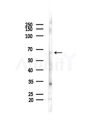 ARHGAP15 Antibody - Western blot analysis of lysates from COLO205 cells(heat-shock,45min treatment), using ARHGAP15 Antibody at 1/1000 dilution.