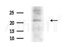 ARL4C Antibody - Western blot analysis of extracts from COLO205 cells(heat-shock treatment), using ARL4C Antibody at 1/1000 dilution.