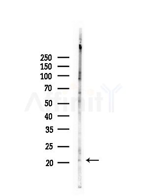ARL4C Antibody - Western blot analysis of lysates from COLO205 cells(heat-shock,45min treatment), using ARL4C Antibody at 1/1000 dilution.