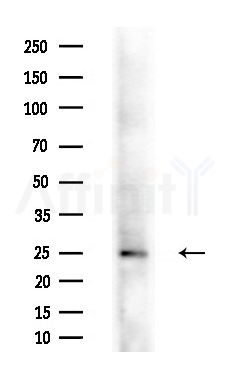 ARL5B Antibody - Western blot analysis of extracts from COLO205 cells(heat-shock treatment), using ARL5B Antibody at 1/1000 dilution.