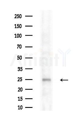 ARL5B Antibody - Western blot analysis of extracts from HUVEC cells(starvation treatment), using ARL5B Antibody at 1/1000 dilution.