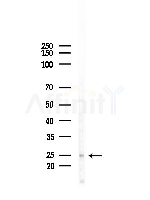 ARL5B Antibody - Western blot analysis of lysates from HUVEC cells(starvation,24h treatment), using ARL5B Antibody at 1/1000 dilution.