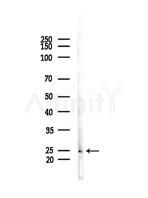 ARL5B Antibody - Western blot analysis of lysates from COLO205 cells(heat-shock,45min treatment), using ARL5B Antibody at 1/1000 dilution.