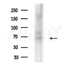 Arp5/ACTR5 Antibody - Western blot analysis of extracts from HUVEC cells(starvation treatment), using Arp5/ACTR5 Antibody at 1/1000 dilution.