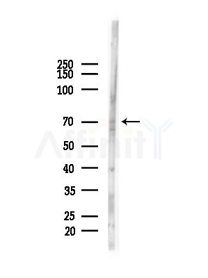 Arp5/ACTR5 Antibody - Western blot analysis of lysates from HUVEC cells(starvation,24h treatment), using Arp5/ACTR5 Antibody at 1/1000 dilution.