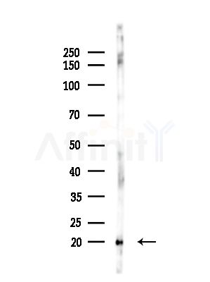 ARPC3 Antibody - Western blot analysis of lysates from LoVo cells(heat-shock,45min treatment), using ARPC3 Antibody at 1/1000 dilution.