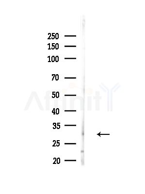 ASPA Antibody - Western blot analysis of lysates from B16F10-LUC cells(heat-shock,45min treatment), using ASPA Antibody at 1/1000 dilution.