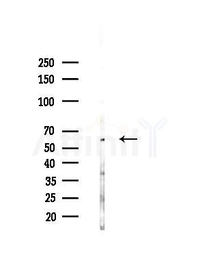 ATL3 Antibody - Western blot analysis of lysates from COLO205 cells(UV,30min treatment), using ATL3 Antibody at 1/1000 dilution.