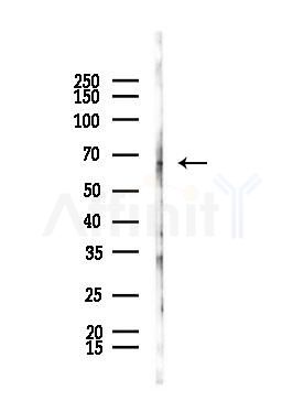AXUD1 Antibody - Western blot analysis of lysates from A375 cells(starvation,24h treatment), using AXUD1 Antibody at 1/1000 dilution.