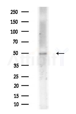 BANP Antibody - Western blot analysis of extracts from Mouse liver, using BANP Antibody at 1/1000 dilution.