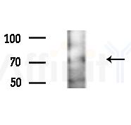 Bestrophin-3 Antibody - Western blot analysis of extracts from A375 cells(heat-shock,45min treatment), using Bestrophin-3 Antibody at 1/1000 dilution.