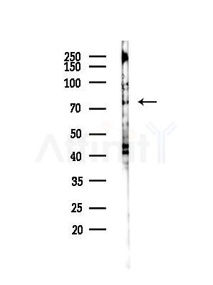 Bestrophin-3 Antibody - Western blot analysis of lysates from A375 cells(heat-shock,45min treatment), using Bestrophin-3 Antibody at 1/1000 dilution.