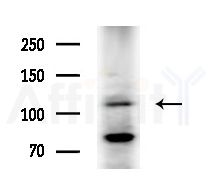 BRD2 Antibody - Western blot analysis of extracts from COLO205 cells(heat-shock treatment), using BRD2 Antibody at 1/1000 dilution.