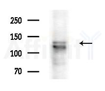C14orf102 Antibody - Western blot analysis of extracts from COLO205 cells(heat-shock treatment), using C14orf102 Antibody at 1/1000 dilution.