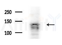 C14orf102 Antibody - Western blot analysis of extracts from HUVEC cells(starvation treatment), using C14orf102 Antibody at 1/1000 dilution.