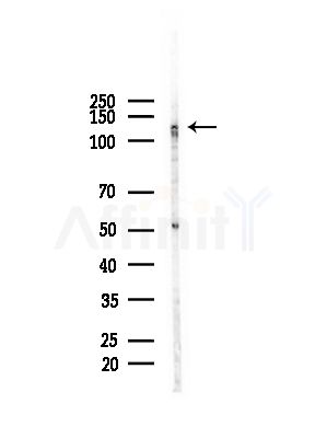 C14orf102 Antibody - Western blot analysis of lysates from HUVEC cells(starvation,24h treatment), using C14orf102 Antibody at 1/1000 dilution.