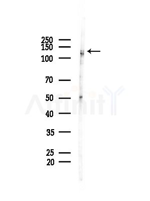 C14orf102 Antibody - Western blot analysis of lysates from COLO205 cells(heat-shock,45min treatment), using C14orf102 Antibody at 1/1000 dilution.
