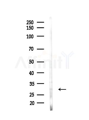 C1orf163 Antibody - Western blot analysis of lysates from LoVo cells(heat-shock,45min treatment), using C1orf163 Antibody at 1/1000 dilution.