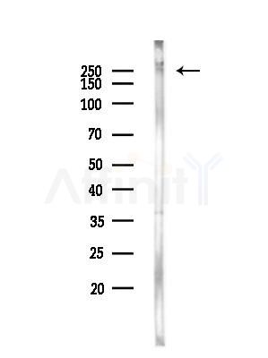 CACNA1B Antibody - Western blot analysis of lysates from Rat liver, using CACNA1B Antibody at 1/1000 dilution.