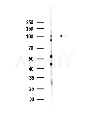Calmegin Antibody - Western blot analysis of lysates from B16F10-LUC cells(heat-shock,45min treatment), using Calmegin Antibody at 1/1000 dilution.