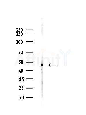 Calumenin Antibody - Western blot analysis of lysates from COLO205 cells(UV,30min treatment), using Calumenin Antibody at 1/1000 dilution.
