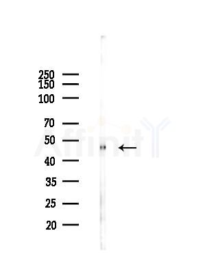 Calumenin Antibody - Western blot analysis of lysates from LoVo cells(heat-shock,45min treatment), using Calumenin Antibody at 1/1000 dilution.