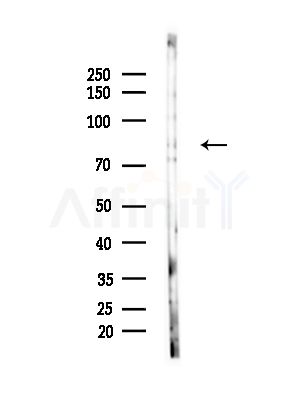 CBFA2T2 Antibody - Western blot analysis of lysates from Rat brain, using CBFA2T2 Antibody at 1/1000 dilution.