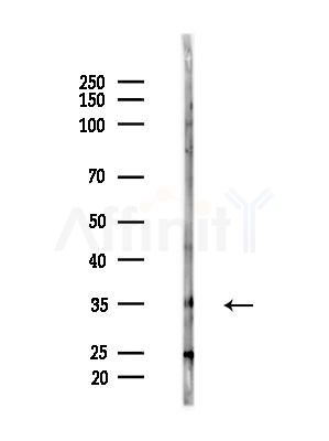CBY1 Antibody - Western blot analysis of lysates from EC304 cells, using CBY1 Antibody at 1/1000 dilution.