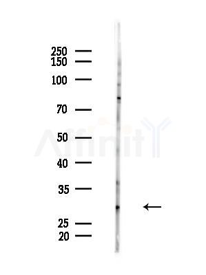 CBY1 Antibody - Western blot analysis of lysates from HepG2 cells(LPS, 4h treatment), using CBY1 Antibody at 1/1000 dilution.