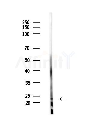 CCDC53 Antibody - Western blot analysis of lysates from HepG2 cells(LPS, 4h treatment), using CCDC53 Antibody at 1/1000 dilution.