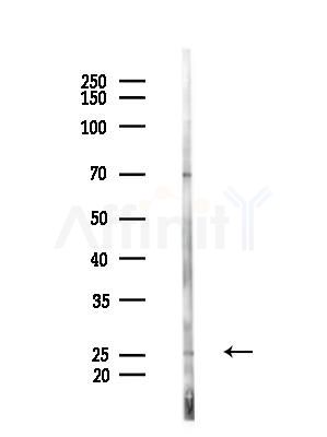 CCDC53 Antibody - Western blot analysis of lysates from EC304 cells, using CCDC53 Antibody at 1/1000 dilution.