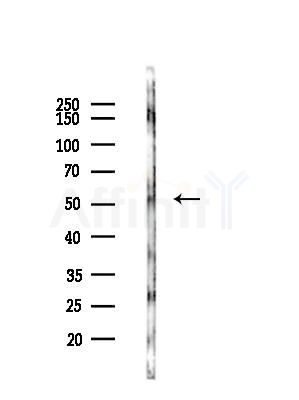 CCM2 Antibody - Western blot analysis of lysates from COLO205 cells(UV,30min treatment), using CCM2 Antibody at 1/1000 dilution.