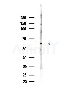 CCT4 Antibody - Western blot analysis of lysates from LoVo cells(heat-shock,45min treatment), using CCT4 Antibody at 1/1000 dilution.