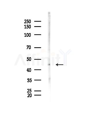CCT4 Antibody - Western blot analysis of lysates from Rat brain, using CCT4 Antibody at 1/1000 dilution.