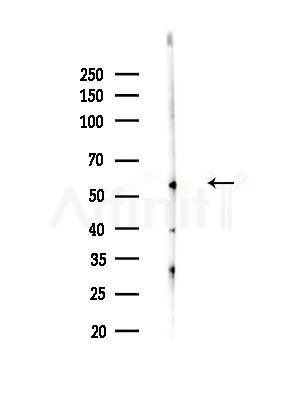CCT4 Antibody - Western blot analysis of lysates from B16F10-LUC cells(heat-shock,45min treatment), using CCT4 Antibody at 1/1000 dilution.