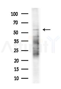 CCT6B Antibody - Western blot analysis of extracts from B16F10-LUC cells(UV,30min treatment), using CCT6B Antibody at 1/1000 dilution.