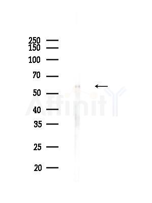 CCT6B Antibody - Western blot analysis of lysates from B16F10-LUC cells(UV,30min treatment), using CCT6B Antibody at 1/1000 dilution.