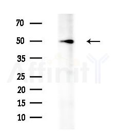 CD84 Antibody - Western blot analysis of extracts from HepG2 cells(LPS 4h treatment), using CD84 Antibody at 1/1000 dilution.