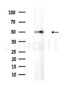 CD84 Antibody - Western blot analysis of extracts from EC304 cells, using CD84 Antibody at 1/1000 dilution.