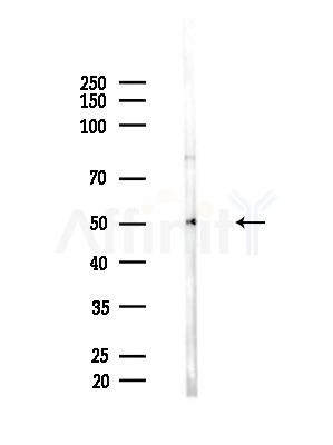 CD84 Antibody - Western blot analysis of lysates from EC304 cells, using CD84 Antibody at 1/1000 dilution.
