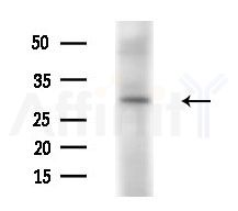 CHMP1A Antibody - Western blot analysis of extracts from Rat brain, using CHMP1A Antibody at 1/1000 dilution.