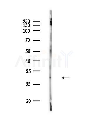 CHMP1A Antibody - Western blot analysis of lysates from Rat brain, using CHMP1A Antibody at 1/1000 dilution.
