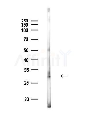 CHMP1B Antibody - Western blot analysis of lysates from Rat brain, using CHMP1B Antibody at 1/1000 dilution.