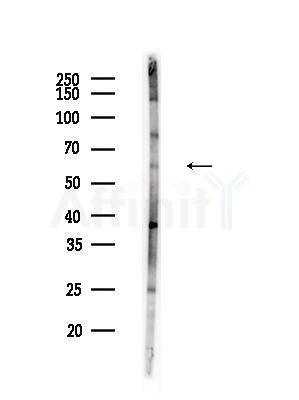 CHMP7 Antibody - Western blot analysis of lysates from B16F10-LUC cells(UV,30min treatment), using CHMP7 Antibody at 1/1000 dilution.